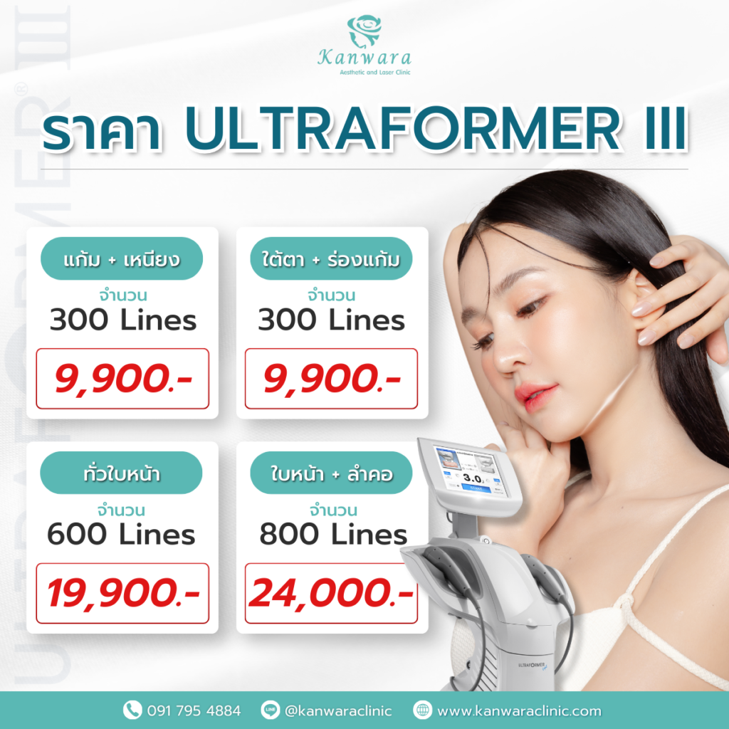 ยกกระชับ Ultraformer III